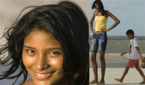 elisany silva|Meet the woman who grew over 2 metres tall due to an  .